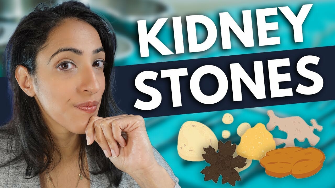 How long does it take to pass a kidney stone (size matters!) | Prevention, Symptoms, & Looks 👀